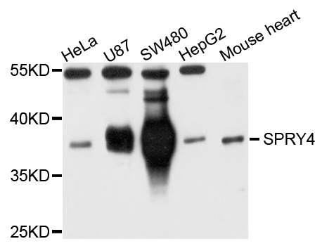 Sprouty 4 / SPRY4 Antibody - Western blot analysis of extracts of A375 cells.