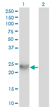 SPRR3 Antibody - Western blot of SPRR3 expression in transfected 293T cell line using antibody SPRR3 monoclonal antibody.