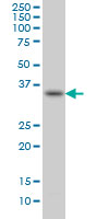 SPRY1 / Sprouty 1 Antibody - SPRY1 monoclonal antibody, clone 3H4. Western blot of SPRY1 expression in HepG2.