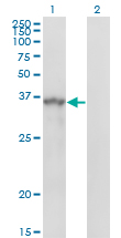 SPRY1 / Sprouty 1 Antibody - Western blot of SPRY1 expression in transfected 293T cell line by SPRY1 monoclonal antibody, clone 3H4.