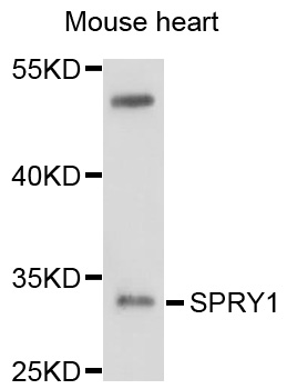 SPRY1 / Sprouty 1 Antibody - Western blot analysis of extracts of mouse heart, using SPRY1 antibody at 1:1000 dilution. The secondary antibody used was an HRP Goat Anti-Rabbit IgG (H+L) at 1:10000 dilution. Lysates were loaded 25ug per lane and 3% nonfat dry milk in TBST was used for blocking. An ECL Kit was used for detection and the exposure time was 10s.