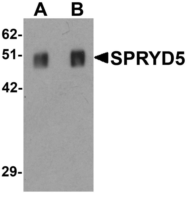 SPRYD5 Antibody - Western blot analysis of SPRYD5 in rat brain tissue lysate with SPRYD5 antibody at (A) 0.25 and (B) 0.5 ug/ml .