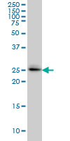 SPSB2 Antibody - GRCC9 monoclonal antibody, clone 1E6 Western blot of SPSB2 expression in A-549.