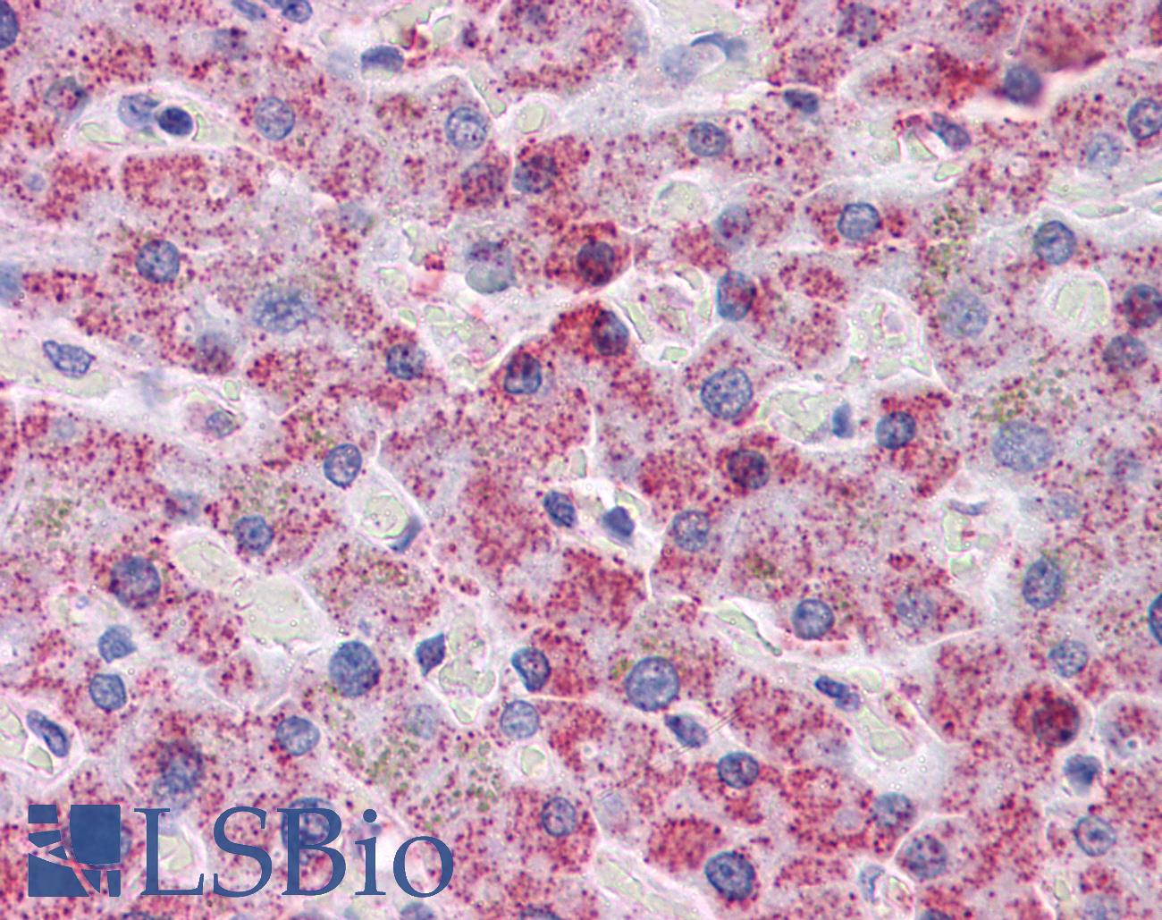 SPSB2 Antibody - Anti-SPSB2 antibody IHC of human liver. Immunohistochemistry of formalin-fixed, paraffin-embedded tissue after heat-induced antigen retrieval. Antibody concentration 5 ug/ml.