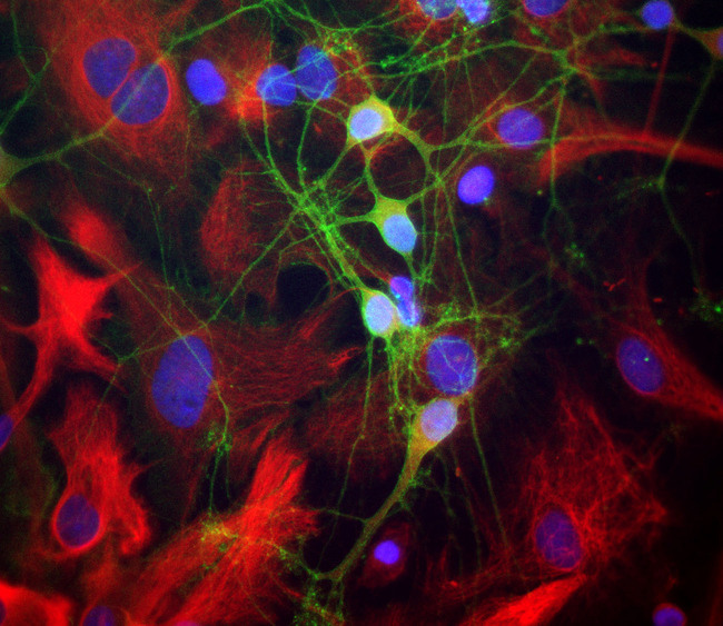 SPTAN1 / Alpha Fodrin Antibody - Mixed neuron-glial cultures stained with rabbit antibody to alpha-II spectrin (green) and mouse polyclonal antibody to Nestin (red). The alpha-II spectrin antibody stains numerous axonal and dendritic profiles in these cultures, clearly revealing the submembranous cytoskeleton. Since alpha-II spectrin is specific for neurons in the CNS, the glial cells in this culture are not recognized by this antibody.