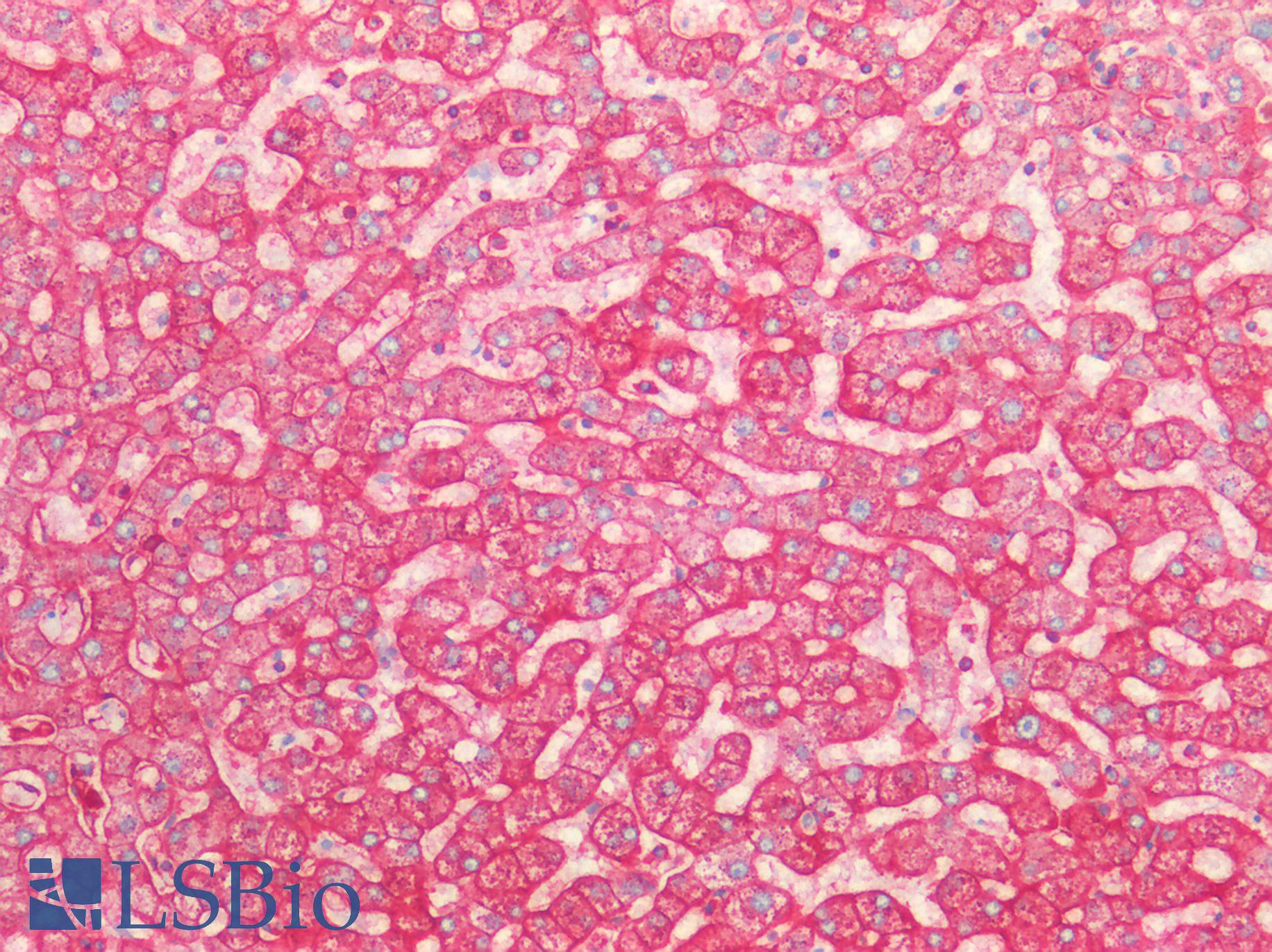 SPTAN1 / Alpha Fodrin Antibody - Human Liver: Formalin-Fixed, Paraffin-Embedded (FFPE)
