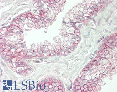 SPTBN2 Antibody - Human Prostate: Formalin-Fixed, Paraffin-Embedded (FFPE)