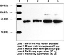 SPTLC2 / LCB2 Antibody - Western blot of SPTLC2 / LCB2 antibody.