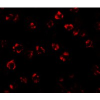 SPTLC2 / LCB2 Antibody - Immunofluorescence of SPT2 in 3T3 cells with SPT2 antibody at 20 µg/mL.