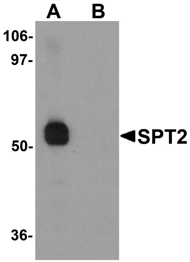 SPTLC2 / LCB2 Antibody - Western blot analysis of SPT2 in 3T3 cell lysate with SPT2 antibody at (A) 0.25 and (B) 0.5 ug/ml.