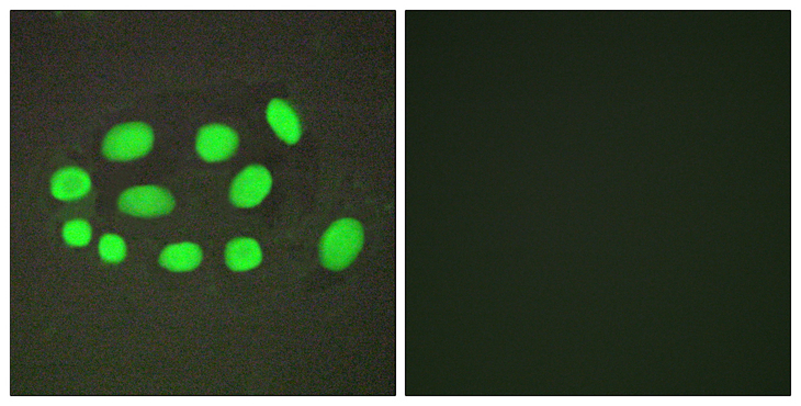 SPZ1 Antibody - Immunofluorescence analysis of A549 cells, using SPZ1 Antibody. The picture on the right is blocked with the synthesized peptide.