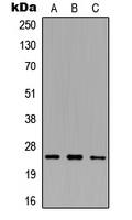 SRA1 / SRA Antibody - Western blot analysis of SRA expression in HEK293T (A); NS-1 (B); PC12 (C) whole cell lysates.