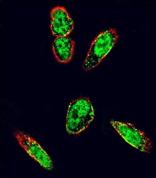 SRC Antibody - Confocal immunofluorescence of SRC Antibody with A375 cell followed by Alexa Fluor 488-conjugated goat anti-rabbit lgG (green). Actin filaments have been labeled with Alexa Fluor 555 phalloidin (red).