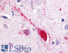 SREB / GPR85 Antibody - Anti-GPR85 antibody IHC of human putamen, neuron. Immunohistochemistry of formalin-fixed, paraffin-embedded tissue after heat-induced antigen retrieval.