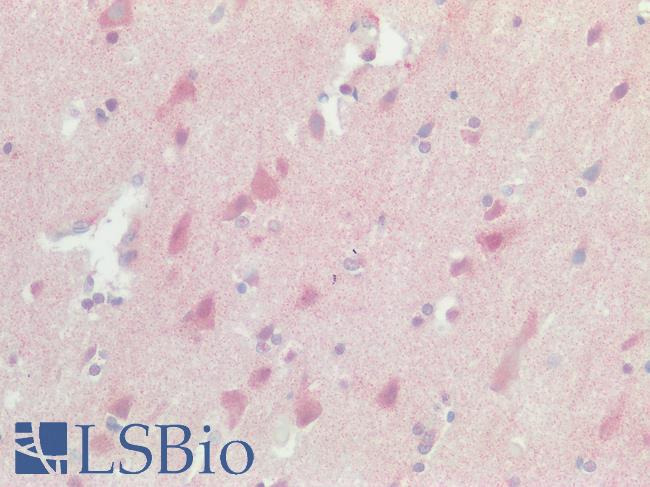 SREB / GPR85 Antibody - Human Brain, Cortex: Formalin-Fixed, Paraffin-Embedded (FFPE)