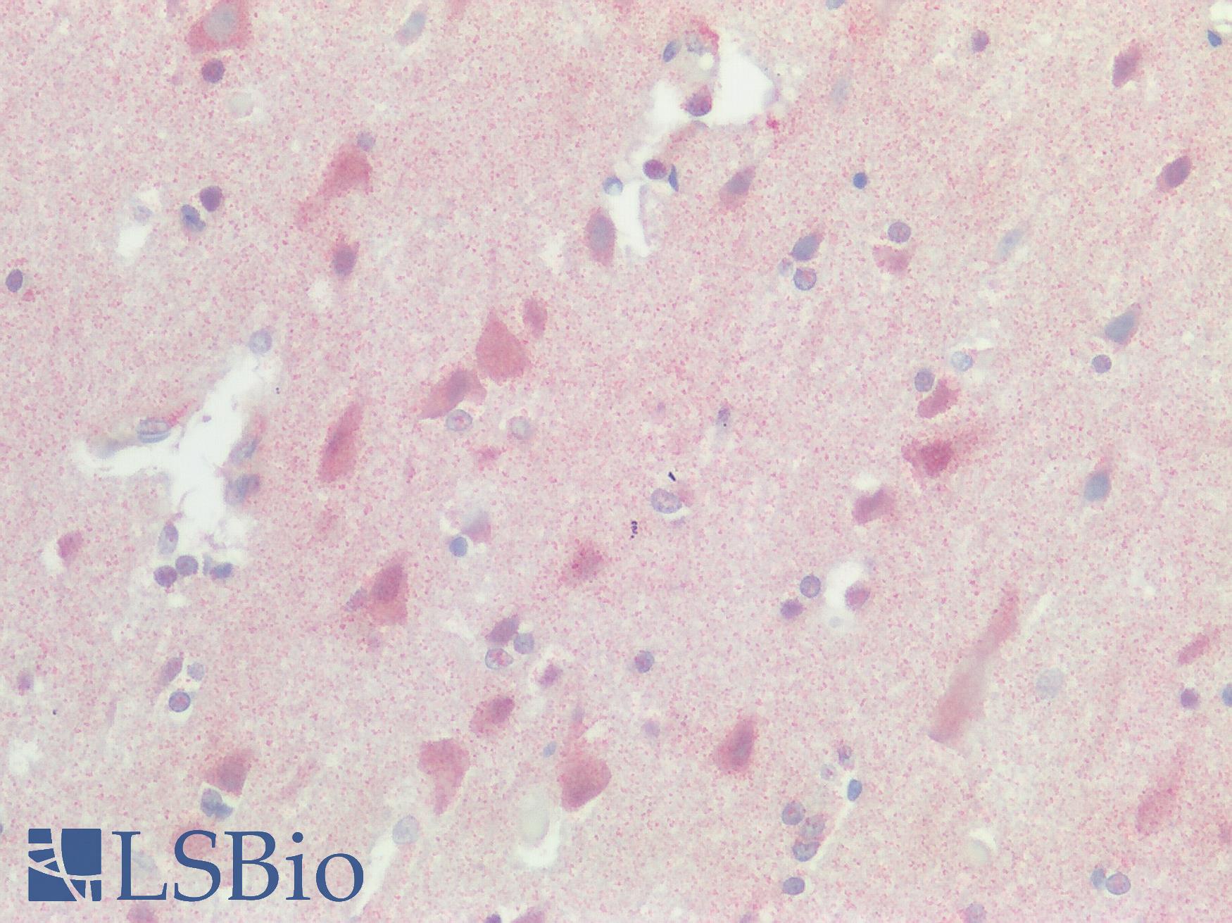 SREB / GPR85 Antibody - Human Brain, Cortex: Formalin-Fixed, Paraffin-Embedded (FFPE)