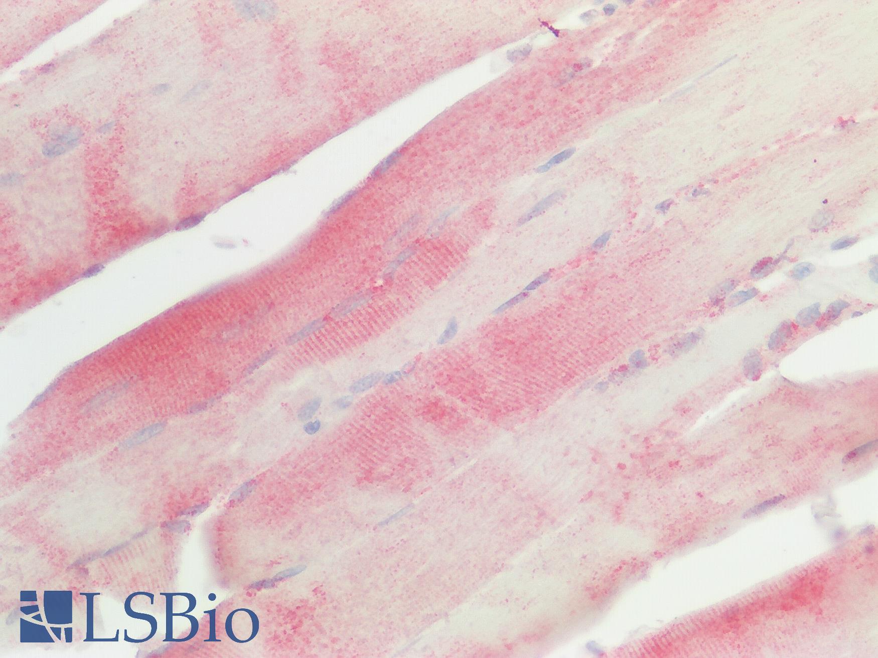 SREB / GPR85 Antibody - Human Skeletal Muscle: Formalin-Fixed, Paraffin-Embedded (FFPE)