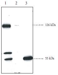 SREBF2 / SREBP2 Antibody - Lane 1: Human fibroblast cell lysate (60 ug); Lane 2: Rat brown fat homogenate (60 ug); Lane 3: Rat testis supernatant (60 ug)