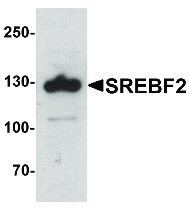 SREBF2 / SREBP2 Antibody - Western blot analysis of SREBF2 in PC-3 cell lysate with SREBF1 antibody at 1 ug/ml.