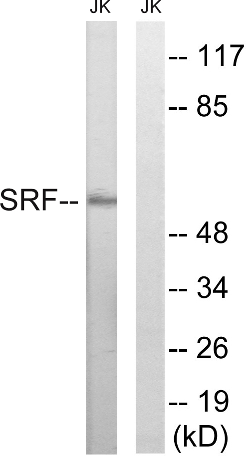 SRF / Serum Response Factor Antibody - Western blot analysis of lysates from Jurkat cells, treated with insulin 0.01U/ml 15', using SRF Antibody. The lane on the right is blocked with the synthesized peptide.
