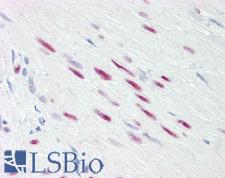 SRF / Serum Response Factor Antibody - Anti-SRF antibody IHC of human prostate, fibromuscular stroma. Immunohistochemistry of formalin-fixed, paraffin-embedded tissue after heat-induced antigen retrieval. Antibody dilution 5 ug/ml.