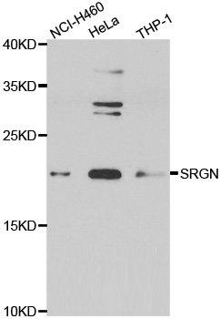 SRGN / Serglycin Antibody - Western blot analysis of extracts of various cell lines.