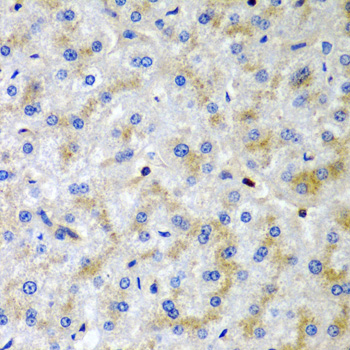 SRGN / Serglycin Antibody - Immunohistochemistry of paraffin-embedded human liver injury tissue.