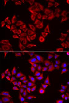 SRGN / Serglycin Antibody - Immunofluorescence analysis of HeLa cells.