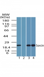 SRI / Sorcin Antibody - Western blot of human Sorcin in human brain lysate in the 1) absence, 2) presence of immunizing peptide, 3) mouse brain and 4) rat brain  using antibody at 1 ug/ml.