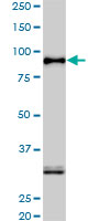 SRPK1 Antibody - SRPK1 monoclonal antibody clone 6H5. Western blot of SRPK1 expression in HepG2.