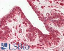 SRPK1 Antibody - Human Breast: Formalin-Fixed, Paraffin-Embedded (FFPE)