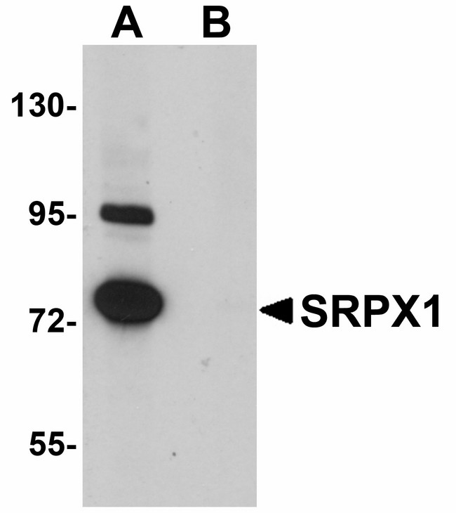 SRPX Antibody - Western blot of SRPX1 in SK-N-SH cell lysate with SRPX1 antibody at 0.25 ug/ml in (A) the absence and (B) the presence of blocking peptide. 