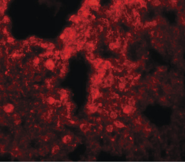SRPX2 Antibody - Immunofluorescence of SRPX2 in human lung tissue with SRPX2 antibody at 20 ug/ml.