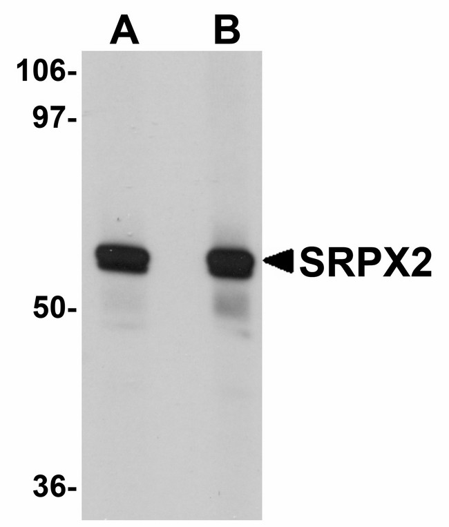 SRPX2 Antibody - Western blot of SRPX2 in human lung tissue lysate with SRPX2 antibody at (A) 1 and (B) 2 ug/ml.