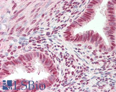 SRRT / ARS2 Antibody - Human Uterus: Formalin-Fixed, Paraffin-Embedded (FFPE)