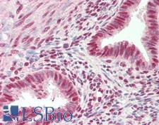 SRRT / ARS2 Antibody - Human Uterus: Formalin-Fixed, Paraffin-Embedded (FFPE)