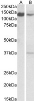 SRRT / ARS2 Antibody - SRRT / ARS2 antibody (0.1µg/ml) staining of Daudi (A) and Mouse Spleen (B) lysates (35µg protein in RIPA buffer). Detected by chemiluminescence.