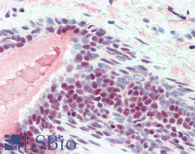 SRSF1 / SF2 Antibody - Anti-SF2 antibody IHC of human breast. Immunohistochemistry of formalin-fixed, paraffin-embedded tissue after heat-induced antigen retrieval. Antibody concentration 10 ug/ml.