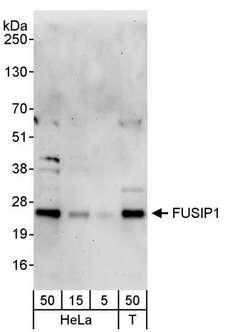 SRSF10 / FUSIP1 Antibody - Detection of Human FUSIP1 by Western Blot. Samples: Whole cell lysate from HeLa (5, 15 and 50 ug) and 293T (T; 50 ug) cells. Antibody: Affinity purified rabbit anti-FUSIP1 antibody used for WB at 0.4 ug/ml. Detection: Chemiluminescence with an exposure time of 3 minutes.