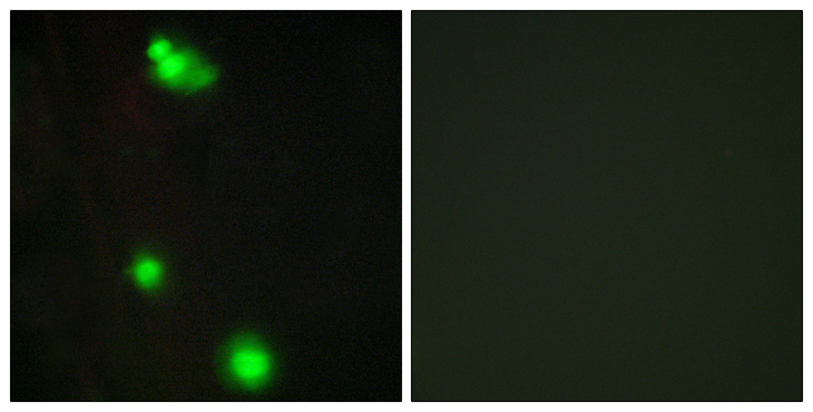 SRSF3 / SRP20 Antibody - Immunofluorescence analysis of MCF7 cells, using SFRS3 Antibody. The picture on the right is blocked with the synthesized peptide.