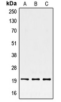 SRSF3 / SRP20 Antibody - Western blot analysis of SRSF3 expression in HepG2 (A); HeLa (B); BJAB (C) whole cell lysates.