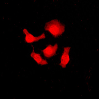 SRSF3 / SRP20 Antibody - Immunofluorescent analysis of SRSF3 staining in HeLa cells. Formalin-fixed cells were permeabilized with 0.1% Triton X-100 in TBS for 5-10 minutes and blocked with 3% BSA-PBS for 30 minutes at room temperature. Cells were probed with the primary antibody in 3% BSA-PBS and incubated overnight at 4 C in a humidified chamber. Cells were washed with PBST and incubated with a DyLight 594-conjugated secondary antibody (red) in PBS at room temperature in the dark. DAPI was used to stain the cell nuclei (blue).
