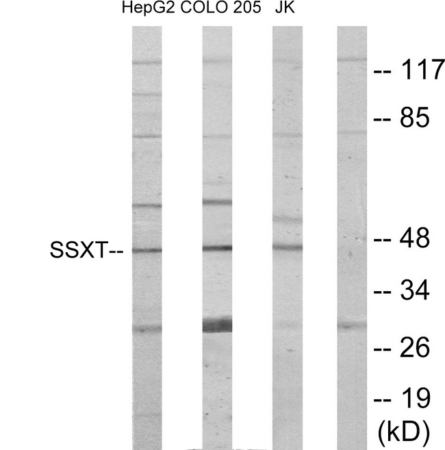 SS18 Antibody - Western blot analysis of lysates from HepG2, Jurkat, and COLO205 cells, using SSXT Antibody. The lane on the right is blocked with the synthesized peptide.