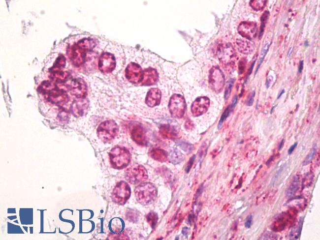 SS18 Antibody - Anti-SS18 / SYT antibody IHC of human prostate. Immunohistochemistry of formalin-fixed, paraffin-embedded tissue after heat-induced antigen retrieval. Antibody dilution 5 ug/ml.