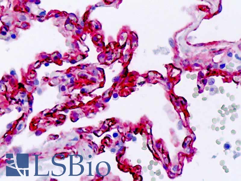 SS18 Antibody - Human, Lung endothelium: Formalin-Fixed Paraffin-Embedded (FFPE)
