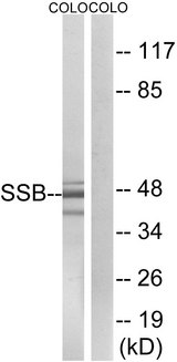 SSB / La Antibody - Western blot analysis of lysates from COLO cells, using SSB Antibody. The lane on the right is blocked with the synthesized peptide.
