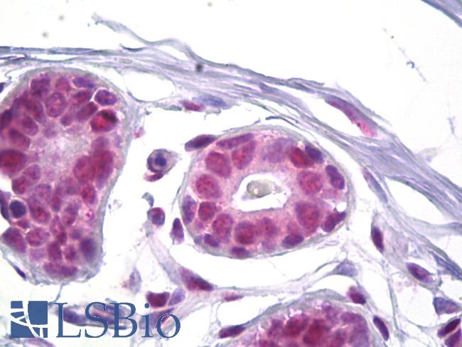 SSB / La Antibody - Anti-SSB antibody IHC of human breast. Immunohistochemistry of formalin-fixed, paraffin-embedded tissue after heat-induced antigen retrieval. Antibody dilution 1:100.