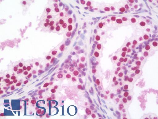 SSB / La Antibody - Anti-SSB / La antibody IHC staining of human prostate. Immunohistochemistry of formalin-fixed, paraffin-embedded tissue after heat-induced antigen retrieval. Antibody concentration 10 ug/ml.