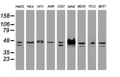 SSB / La Antibody - Western blot of extracts (35 ug) from 9 different cell lines by using anti-SSB monoclonal antibody.