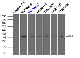 SSB / La Antibody - Immunoprecipitation(IP) of SSB by using monoclonal anti-SSB antibodies (Negative control: IP without adding anti-SSB antibody.). For each experiment, 500ul of DDK tagged SSB overexpression lysates (at 1:5 dilution with HEK293T lysate), 2 ug of anti-SSB antibody and 20ul (0.1 mg) of goat anti-mouse conjugated magnetic beads were mixed and incubated overnight. After extensive wash to remove any non-specific binding, the immuno-precipitated products were analyzed with rabbit anti-DDK polyclonal antibody.